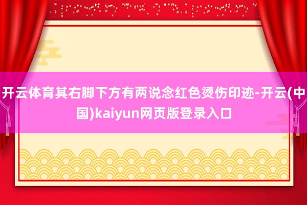 开云体育其右脚下方有两说念红色烫伤印迹-开云(中国)kaiyun网页版登录入口